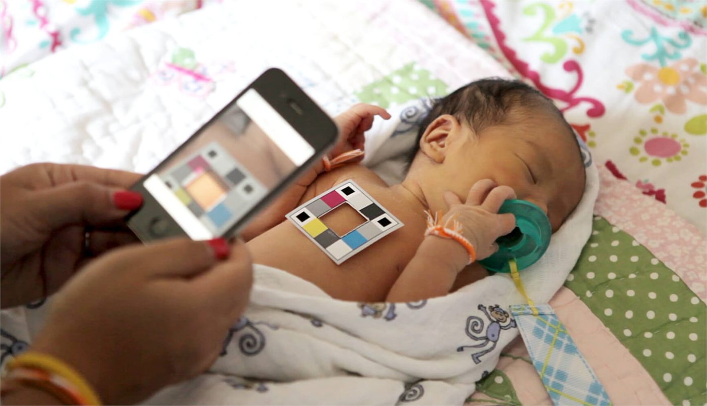 Non-invasive bilirubin sensing